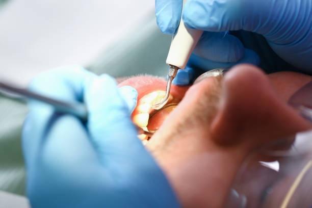 Best After-Hours Dental Trauma Care in St Joseph, MI