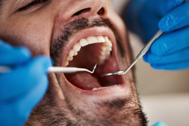 Best Emergency Treatment for Dental Infections or Abscesses in St Joseph, MI