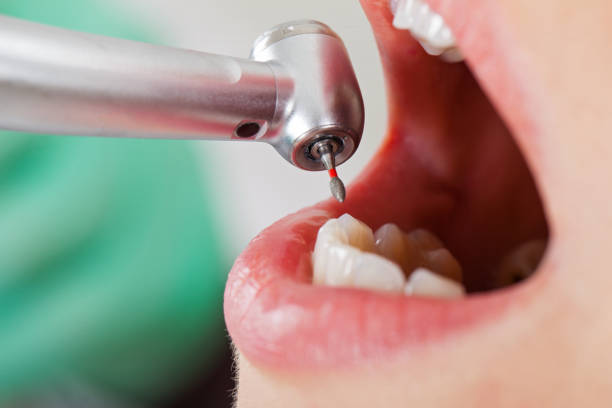 Best Urgent Care for Lost Fillings or Crowns in St Joseph, MI